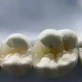 为什么现在看牙那么贵？_2