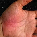 手掌上这块肉，一看就知道你身体好不好！_0