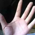 手掌上这块肉，一看就知道你身体好不好！_4