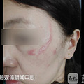 连续接诊7个孩子！夏天意外伤害太多，医生写出这篇防护指南_0