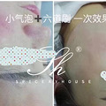 瞅瞅，六道刷做完的效果。 美白补水修护，杠杠滴！
