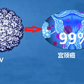 ȾHPVô ŮҪβܷסHPVȾ?