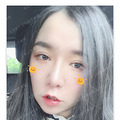 内外眼角修复让你的眼角告别圆钝_2