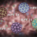 HPVȾŮѲҪţ֡԰