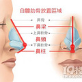 杭州时光整容-鼻子对侧颜的影响，简直教科书级别！_1