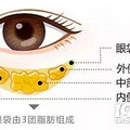 杭州时光整容-眼袋毁颜值，祛眼袋要趁早！_0