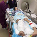 姑娘相亲遇车祸右腿截肢，男方：嫁给我，就垫医疗费_5