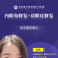 #王世勇眼角修复#眼角圆钝，眼睛无神呆滞该如何改善呢？