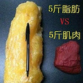 杭州时光整容-科普|吸脂以后还会发胖吗？
