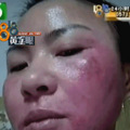 整容手术监控画面曝光：你这是要脸，还是要命？_4