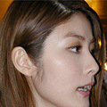 一位大佬写的医美项目普及，想跟大家分享一下~_1