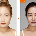 一位大佬写的医美项目普及，想跟大家分享一下~_0