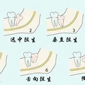古人为什么不用拔智齿？_0