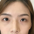 只是改变了眼睛，整个人就大变样！有人说像郭碧婷_2
