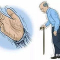 帕金森？社交癌症？杭七专家提醒：悠着点儿，帕金森不是单纯的