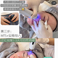 20+女生医美小白初体验_2