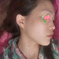20+女生医美小白初体验_4