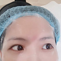 20+女生医美小白初体验_5