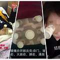 腰痛的受不了？艾灸这几个穴位吧，效果不要太好！_1
