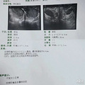 月薪2万却昼夜颠倒，杭州姑娘2个月没来“大姨妈”，医生还说…_3