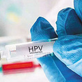 2021���ݾż�HPV����ԤԼָ�ϣ�����_���_�۸�