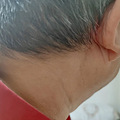 他们用半生时间等待失明_3