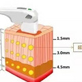 了解超声刀工作原理盘点超声刀效果好吗~_2