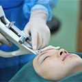 水光针的成分是什么东西、水光针打了多久看到效果、释怀了~_2