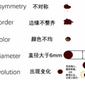 杭州男孩强忍剧痛做切痣手术，妈妈直呼佩服他的勇敢