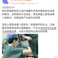 全脸线雕有什么危害、吃瓜群众快看脸部线雕的副作用和危害~_5