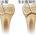 打篮球长高，练体操变矮？别逗了，你的身高早就被基因定好了