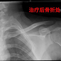 杭州诊所地方挤满人，这个毛病好多人都有…_2