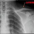 杭州诊所地方挤满人，这个毛病好多人都有…_0