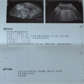 1个多小时，医生给我做了5个手术，宛如超值大礼包！