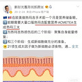热玛吉的原理和功效、热玛吉可以去除法令纹吗~_4