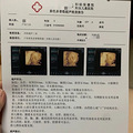 尿盆里都是暗红色血块，我第一次被建议终止妊娠