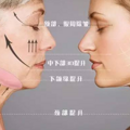 妈呀、线雕3个月脸越来越大怎么办、面部线雕的副作用和危害~_3