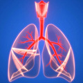 体检查出“肺结节”怎么办？3个等级帮你判断_0