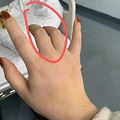 第1天拧不开瓶盖，第3天我穿不上衣服裤子，全身瘫痪了_1