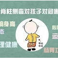 让孩子更“正直”！脊柱侧弯要早发现、早纠正_3