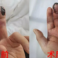 不少人的心头爱，冲上热搜第一！疾控提醒：已有多人中招……