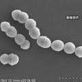 致死率达30%！日本的“食人菌感染”是种什么病？