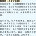 30岁女子胸部成“马蜂窝”！警惕这种“不死癌症”_1
