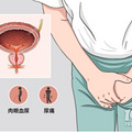 患上膀胱炎，什么水果和蔬菜能帮助减轻症状？记住以下七种食品