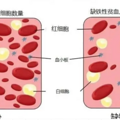 12岁女孩一天喝3杯…被确诊！许多人每天不离手，医生提醒_2