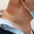 男子自以为魅力十足？医生从他的身上割下10斤重的...._3