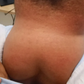 男子自以为魅力十足？医生从他的身上割下10斤重的...._2