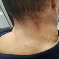 男子自以为魅力十足？医生从他的身上割下10斤重的...._0