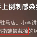 天冷高发，严重可致截肢！杭州又有人因此进急诊_5