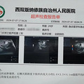 观鸟时被绊倒，我一屁股杵在了栅栏的木头尖尖上_0
